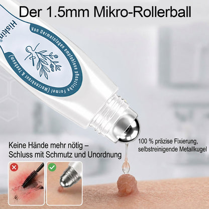 80%Off💥Hiskin ® 7-𝐷𝑎𝑦 𝗧𝐚𝐠 & 𝗦𝗽𝐨𝐭 𝐄𝐫𝒂𝒔𝒆𝒓(Zero Pain, Zero 𝐒𝐜𝐚𝒓𝒔 Rollerball)