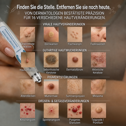 80%Off💥Hiskin ® 7-𝐷𝑎𝑦 𝗧𝐚𝐠 & 𝗦𝗽𝐨𝐭 𝐄𝐫𝒂𝒔𝒆𝒓(Zero Pain, Zero 𝐒𝐜𝐚𝒓𝒔 Rollerball)